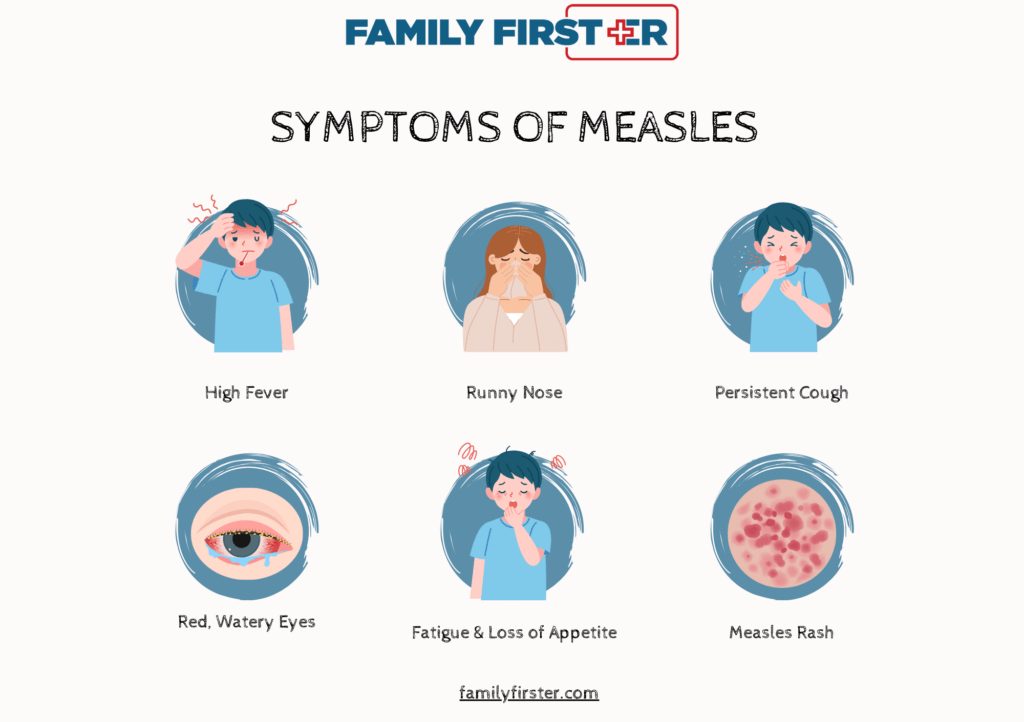 Measles Facts 1 in 5 unvaccinated individuals with measles will require hospitalization. 1 in 20 children with measles develops pneumonia. 1 in 1,000 cases results in encephalitis, which can lead to lifelong disabilities. 1 to 3 in 1,000 cases are fatal, even with medical care.